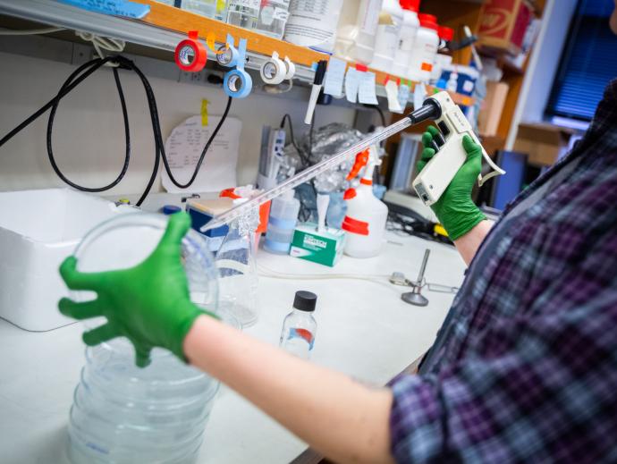 arm of woman in plaid shirt with lab equipment